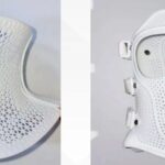 The Power of 3D Printed Orthopedic Braces