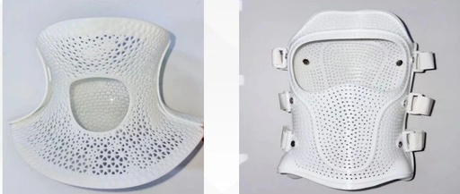 The Power of 3D Printed Orthopedic Braces