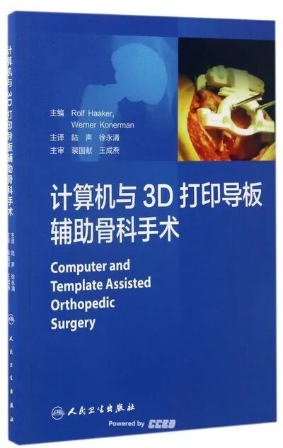 Computer-Assisted Orthopedic Surgery with 3D Printed Guides