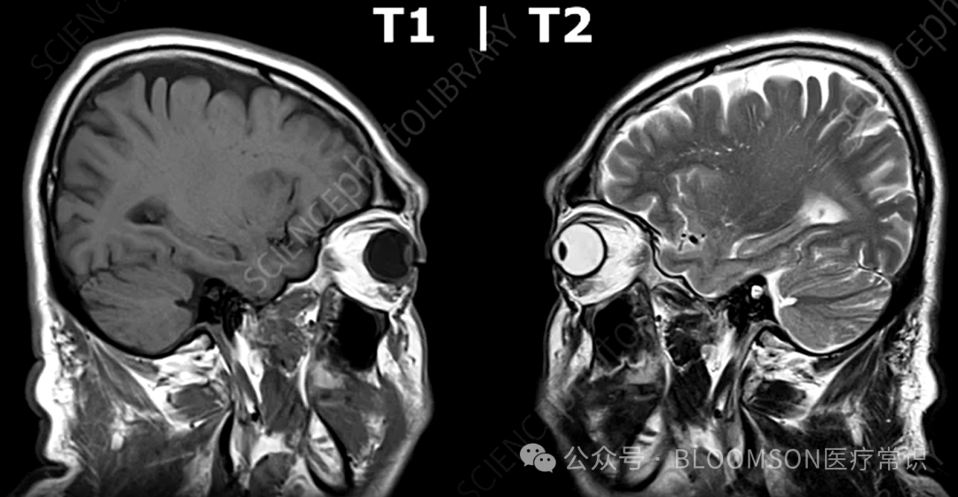 Overview of DWI and ADC Values in MRI