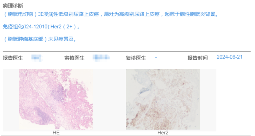 Application of ADC Drugs in Organ Preservation for High-Risk Non-Muscle Invasive Urothelial Carcinoma Patients