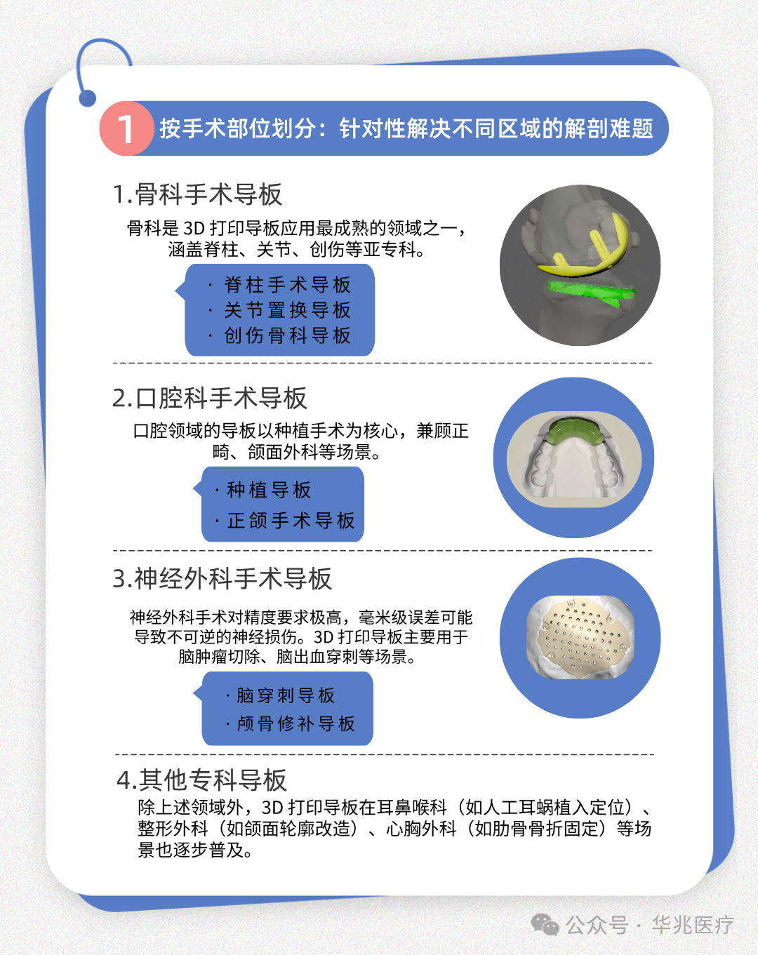 Classification and Application of 3D Printed Surgical Guides