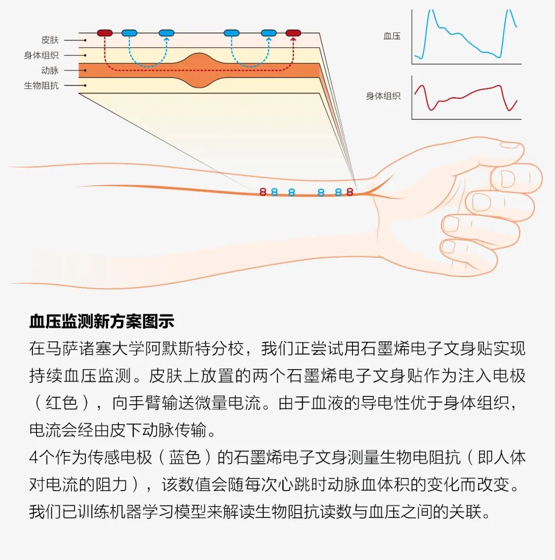 Graphene Biosensor Tattoos: A Glimpse into the Future of Health Monitoring