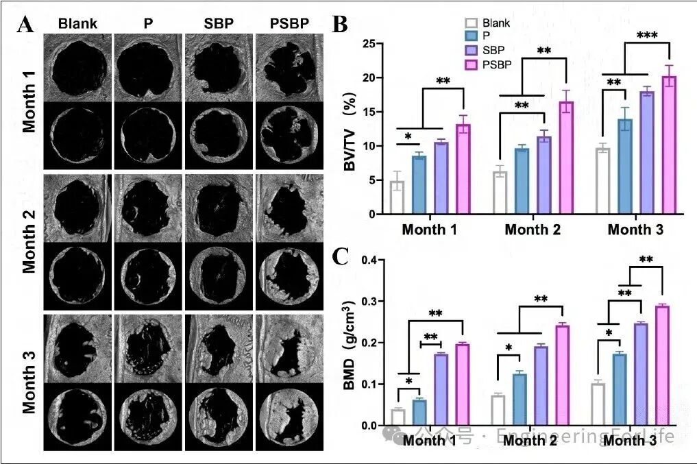 3D Printed Strontium-Doped Bioactive Glass/Polycaprolactone Scaffolds Enhance Immunomodulation and Bone Repair through Polydopamine Surface Modification
