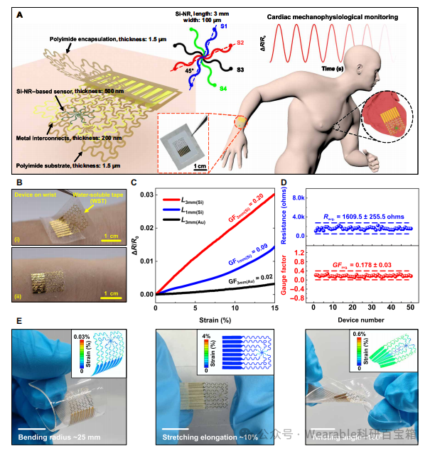 Electronic Tattoos for the Heart: Biodegradable Strain Sensors for Real-Time Detection of Myocardial Infarction