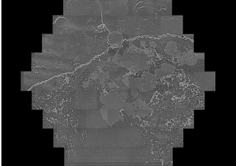 Discussion on Advanced Biomedical Imaging Equipment (Series 14: MultiSEM 505 Ultra-High-Throughput Multi-Beam Field Emission Scanning Electron Microscope)