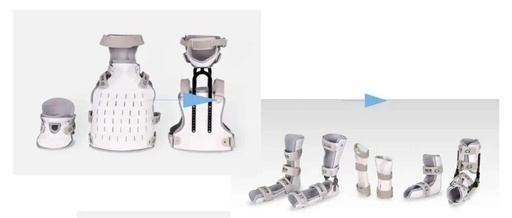 Goodbye to Heavy Plaster: Instant 3D Printing for Precise Orthopedic Rehabilitation!