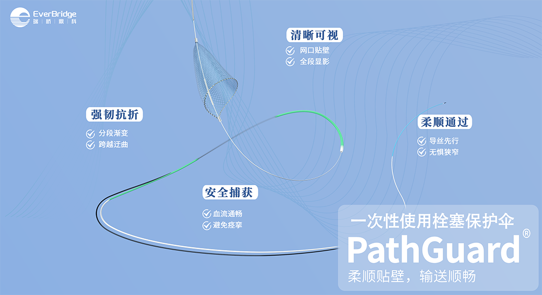Application of the C-Balloon® Catheter Combined with the PathGuard® Umbrella for Endovascular Treatment of Floating Thrombus at the Carotid Artery Bifurcation