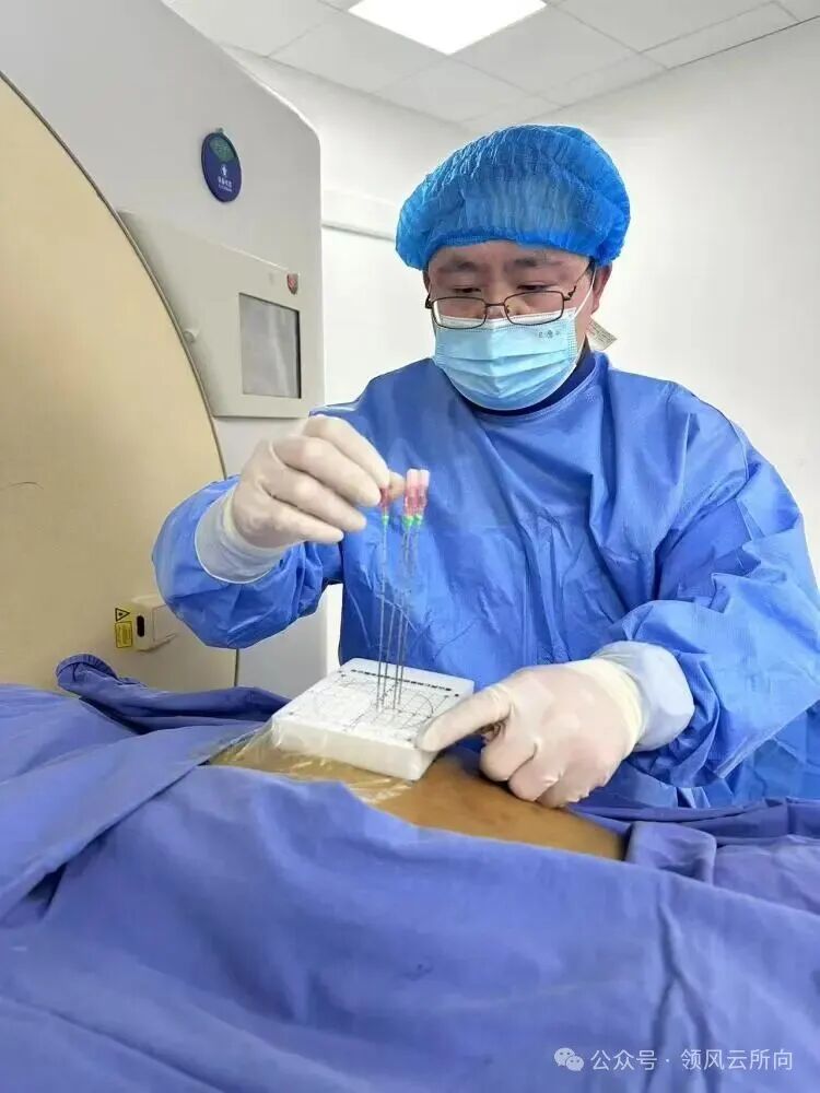 Minimally Invasive Tumor Techniques Series - 3D Printed Coplanar Template-Assisted Radioactive Particle Implantation