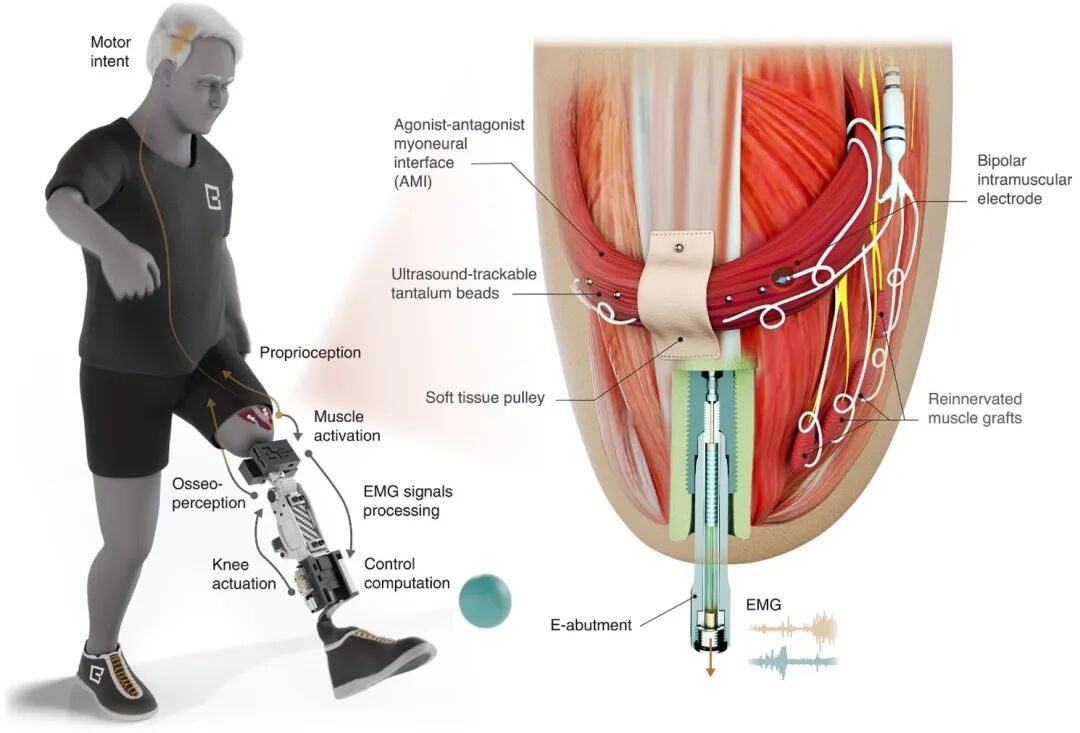 New Technologies | Medical Robotics Industry News (Fourth Issue of 2025)