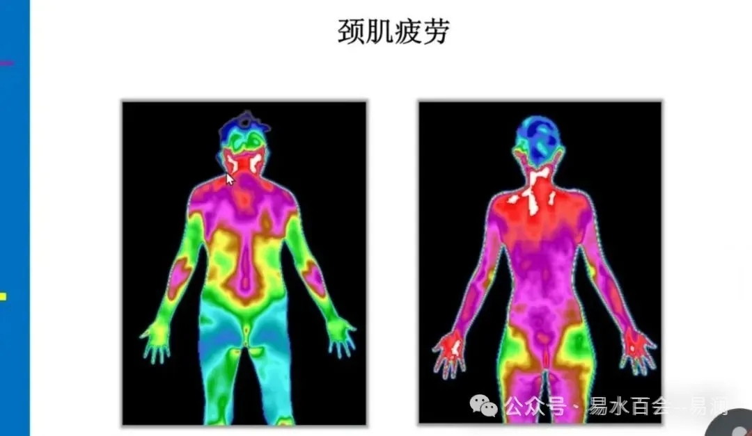 The Infrared Thermal Imaging Device Used in Physiotherapy Clinics: A New Technology for Diagnosis and Visible Therapeutic Effects