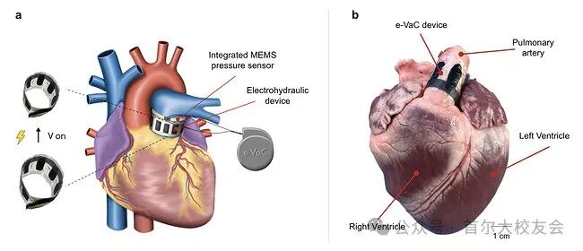 Medical Robotics Technology and Development Trends