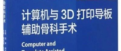 Computer-Assisted Orthopedic Surgery with 3D Printed Guides