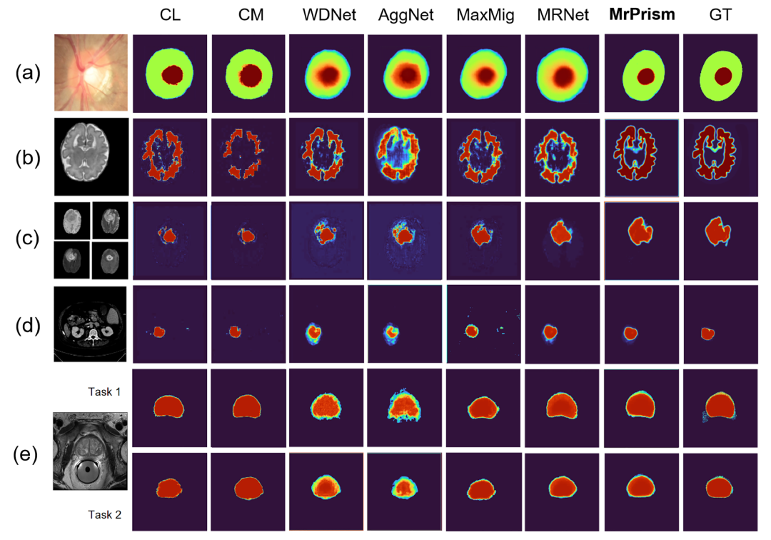 Multi-rater Prism Framework: Achieving Self-calibrated Medical Image Segmentation from Multiple Annotators