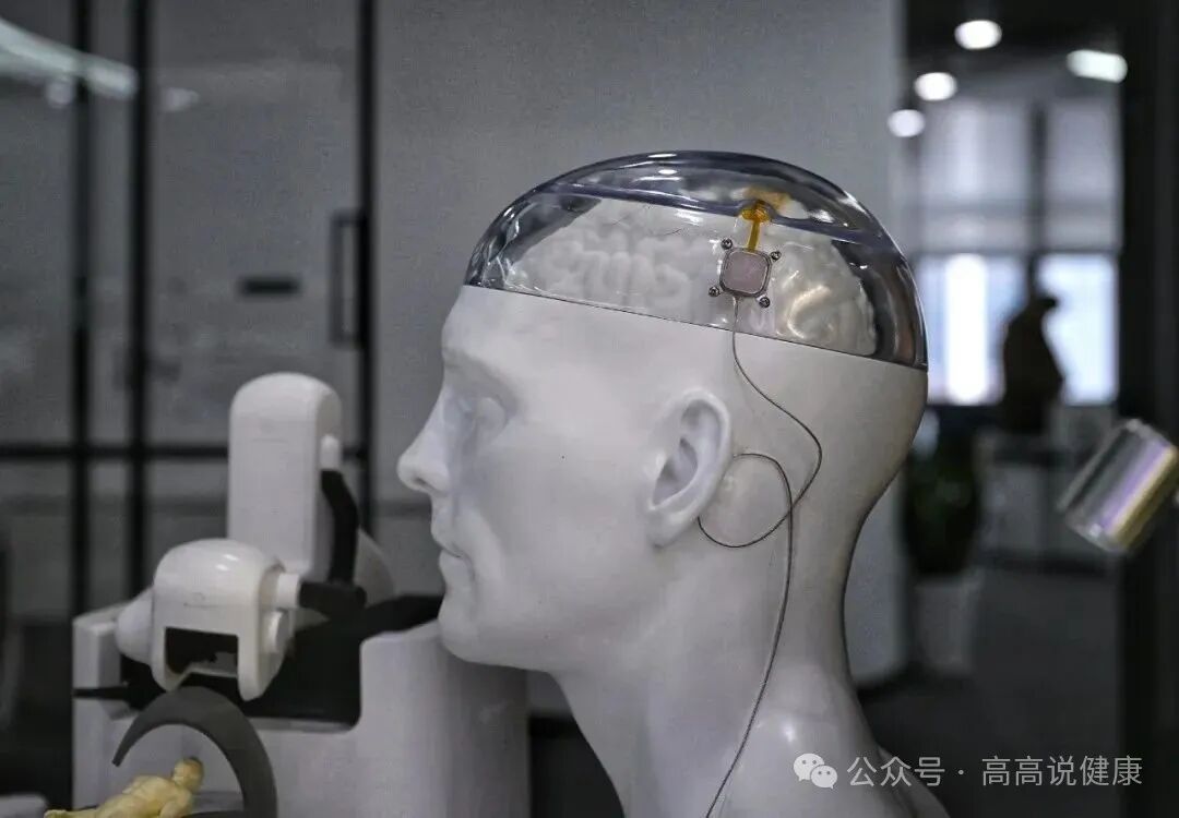 AI Robots Meet Acupuncture? Unveiling 5 Cutting-Edge Technologies in Cerebral Palsy Rehabilitation!