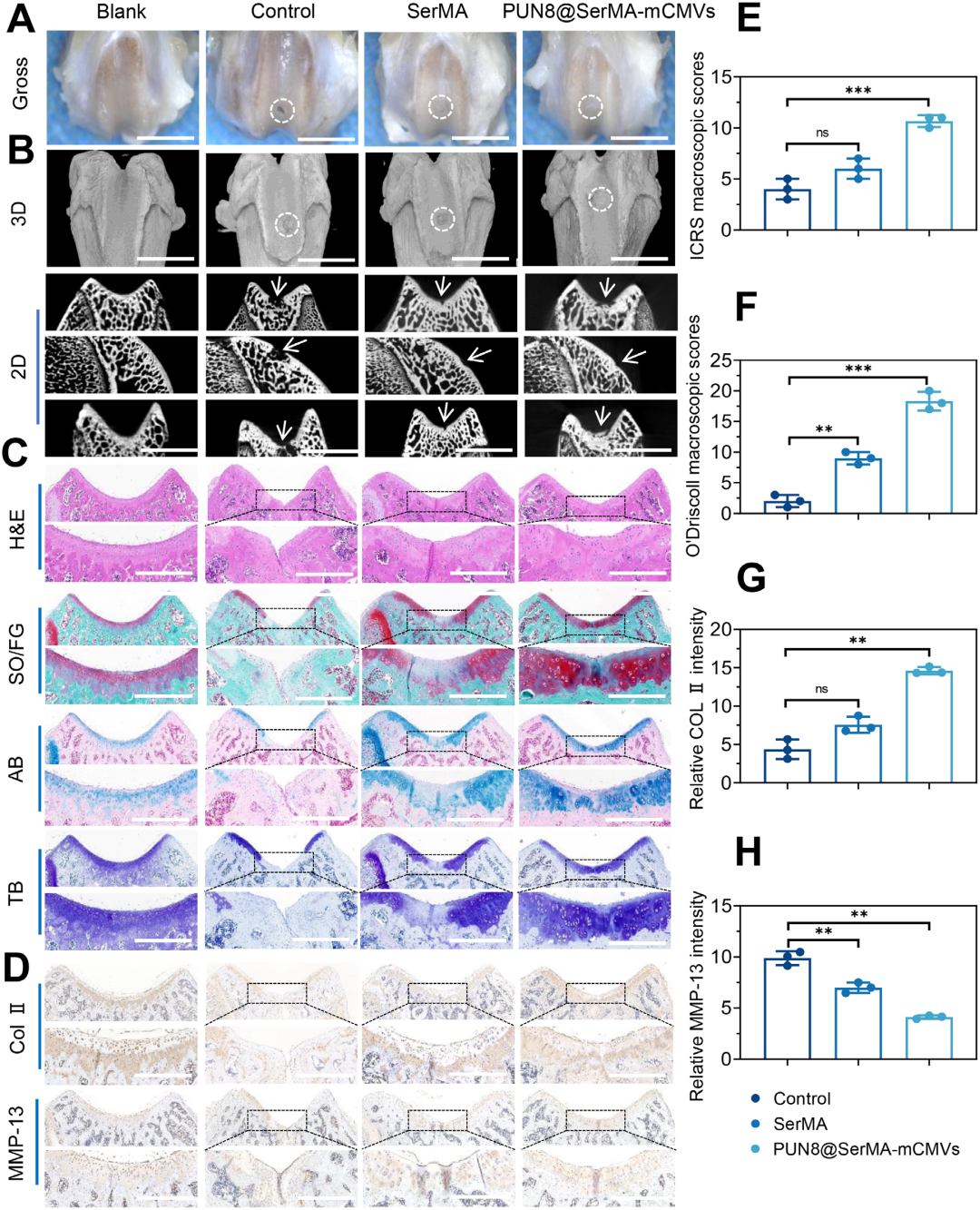 3D Bioprinting! Cellular Capsule Delivery Strategy for Cartilage Defect Repair