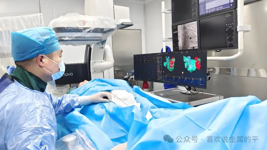 Can Smartwatch ECG Features Truly Warn of Atrial Fibrillation? Doctors Say: A Helper, Not the Gold Standard for Diagnosis