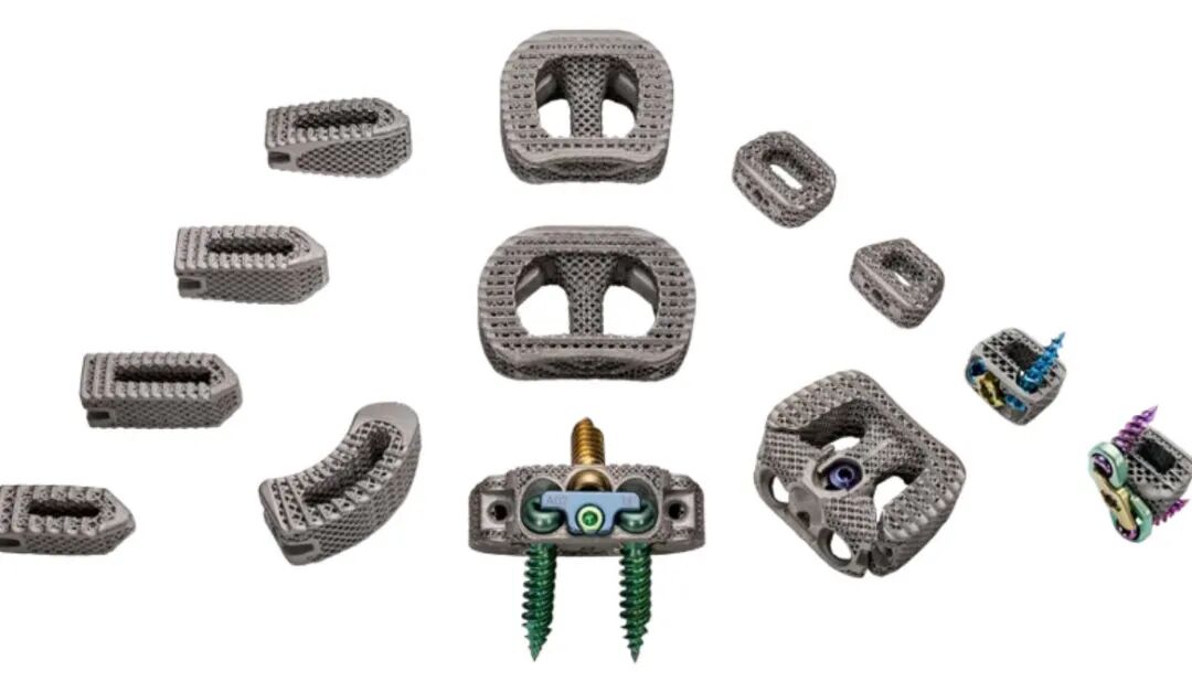 Metal 3D Printing of Orthopedic Implants Becomes an Investment Hotspot