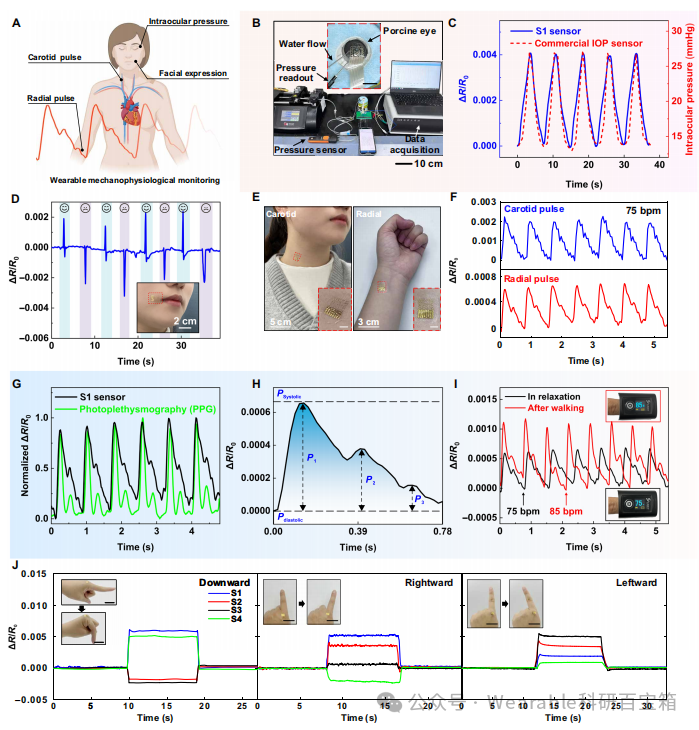 Electronic Tattoos for the Heart: Biodegradable Strain Sensors for Real-Time Detection of Myocardial Infarction