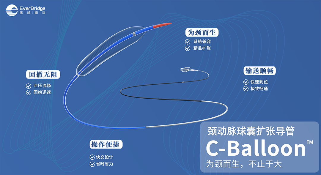 Application of the C-Balloon® Catheter Combined with the PathGuard® Umbrella for Endovascular Treatment of Floating Thrombus at the Carotid Artery Bifurcation