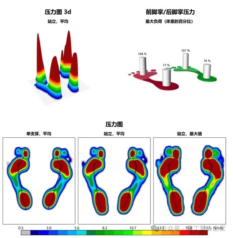 3D Printed Orthotic Insoles: Technology for Healthier Steps!