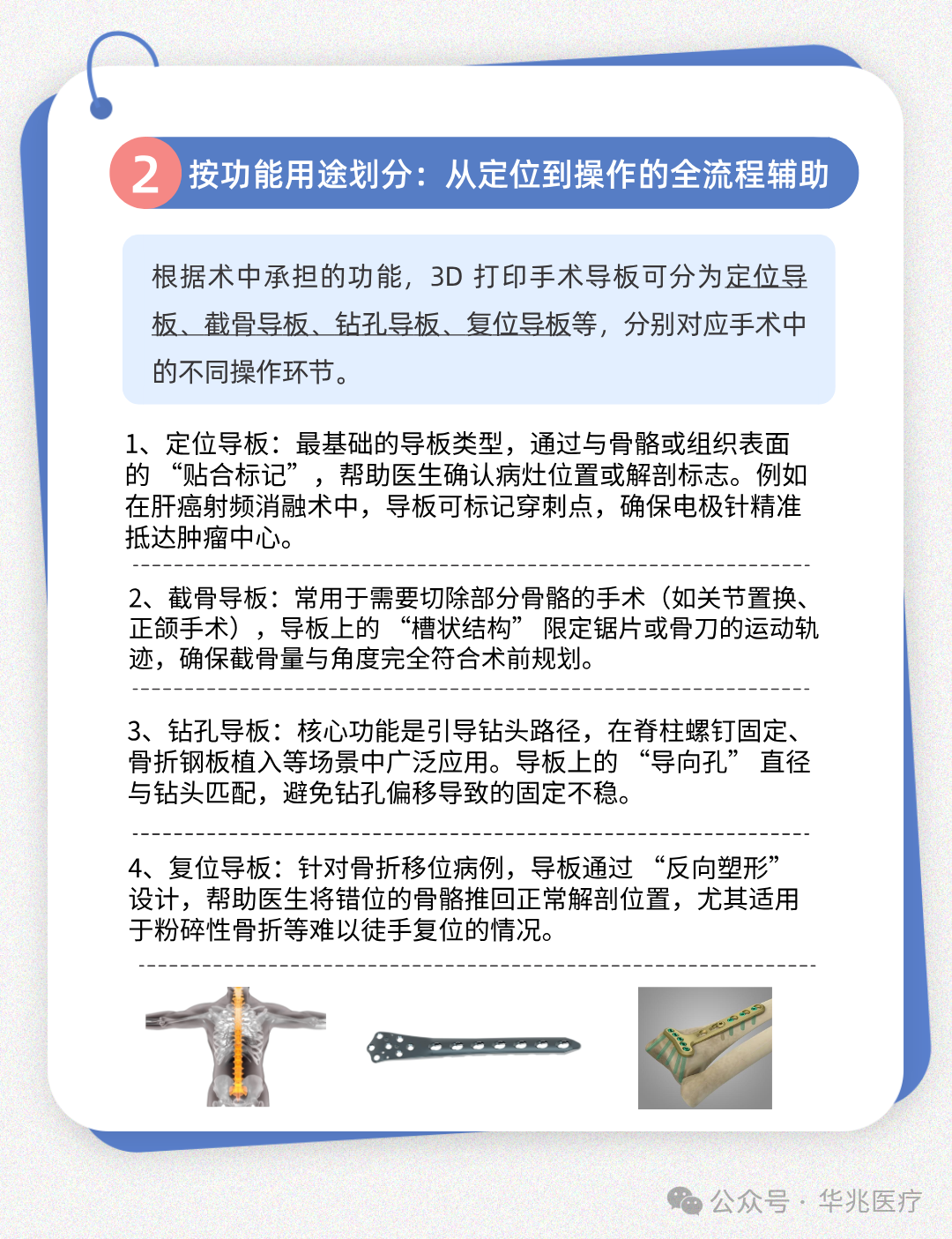 Classification and Application of 3D Printed Surgical Guides
