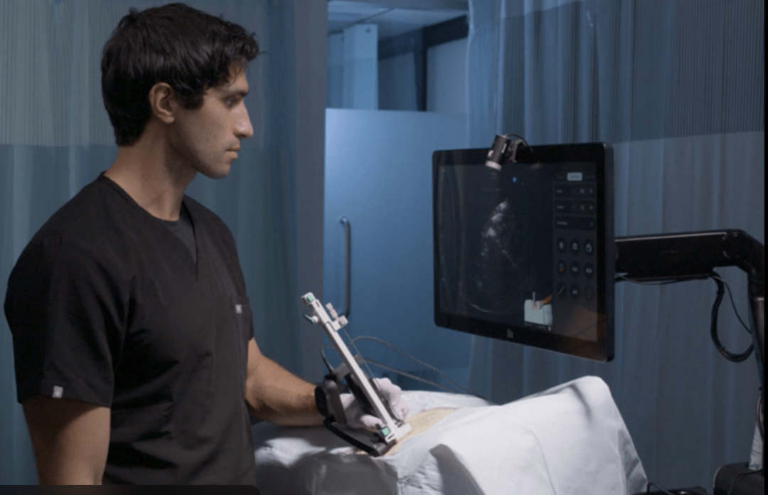 World's First Clinical Application! Breakthrough in Ultrasound + Handheld Robot for Kidney Stone Surgery