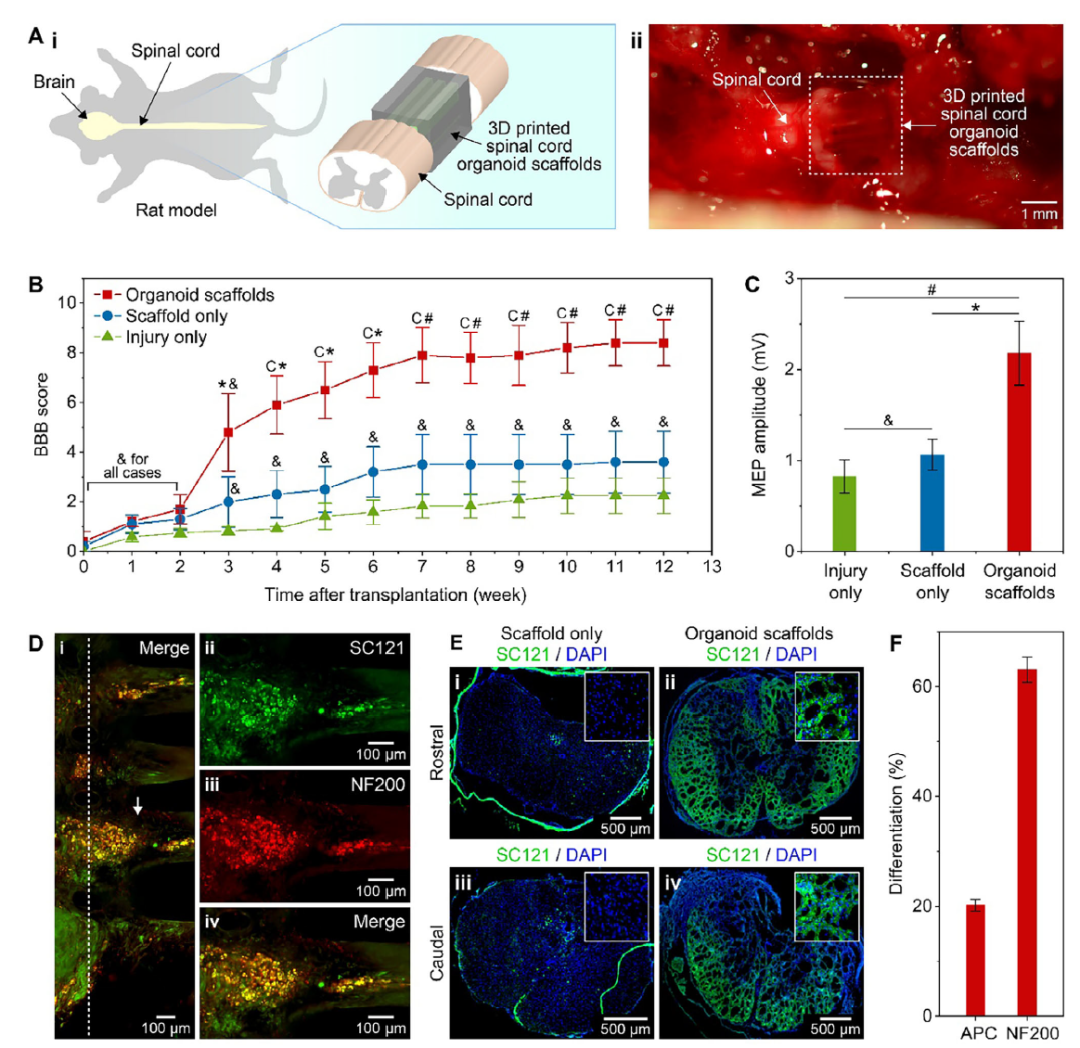 3D-Printed Scaffolds Promote Enhanced Spinal Organoid Formation for Use in Spinal Cord Injury