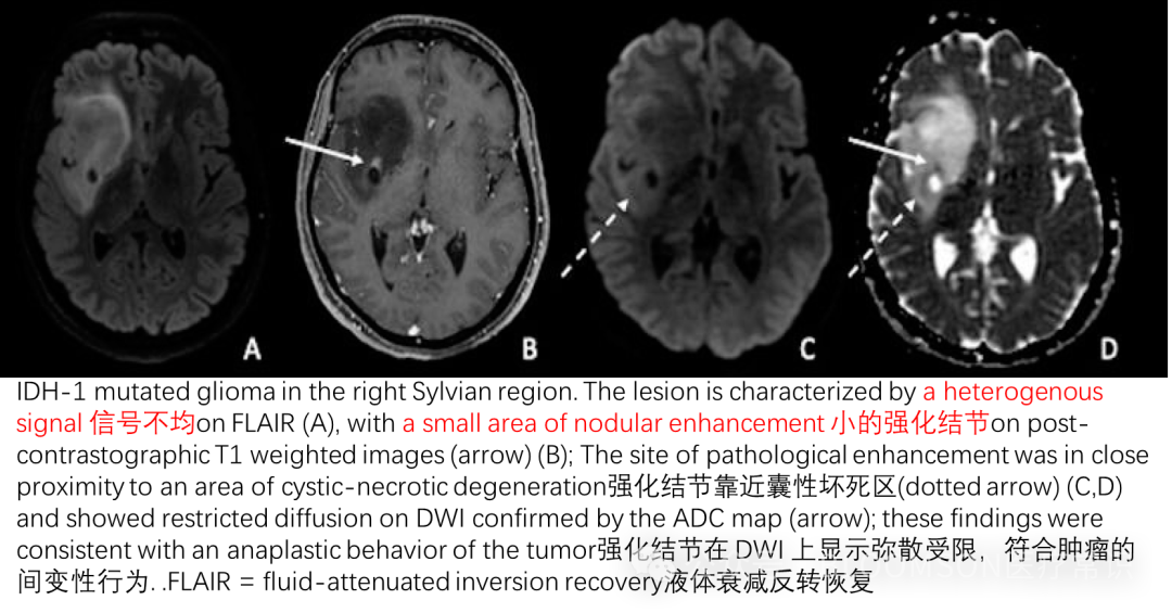 Overview of DWI and ADC Values in MRI