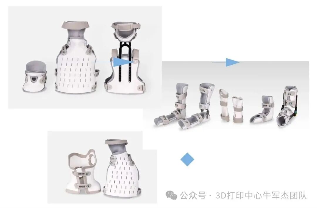 Goodbye to Heavy Plaster: Instant 3D Printing for Precise Orthopedic Rehabilitation!