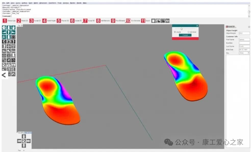 3D Printed Orthotic Insoles: Technology for Healthier Steps!