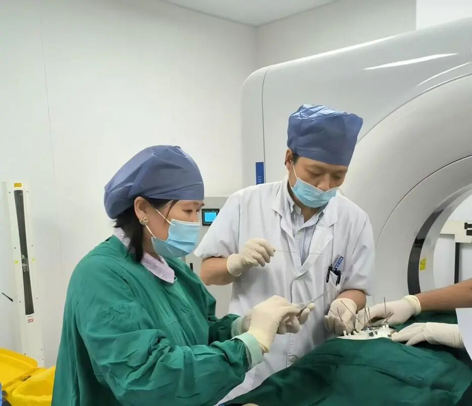 3D Printing Precision Guidance for Large Segment Implant Radiation Therapy Successfully Targets Complex Uterine Sarcoma Metastases