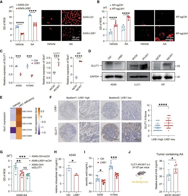 Southern Medical University Study: Vitamin C Combined with Immunotherapy Breaks Through Lung Cancer Drug Resistance