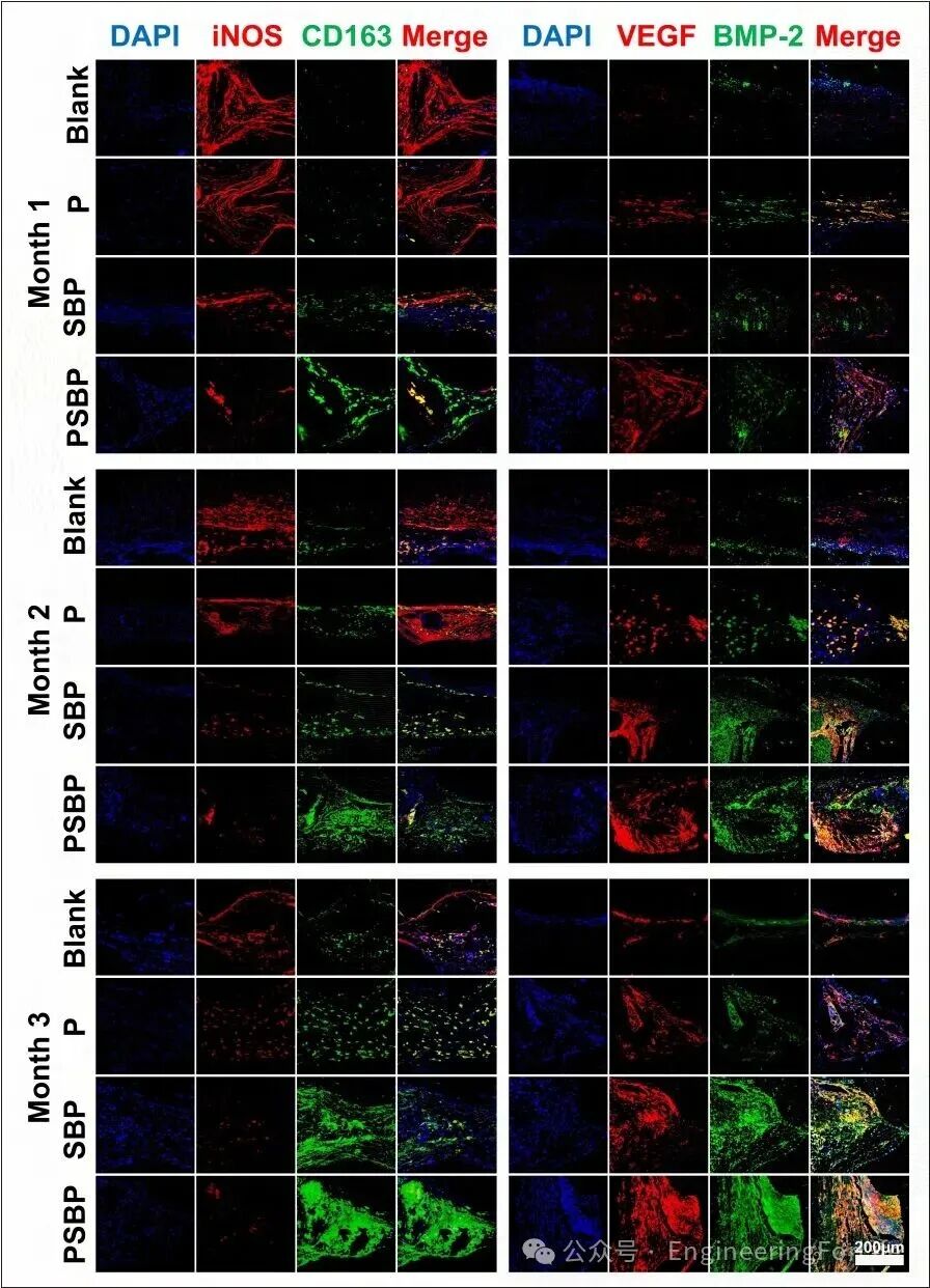3D Printed Strontium-Doped Bioactive Glass/Polycaprolactone Scaffolds Enhance Immunomodulation and Bone Repair through Polydopamine Surface Modification