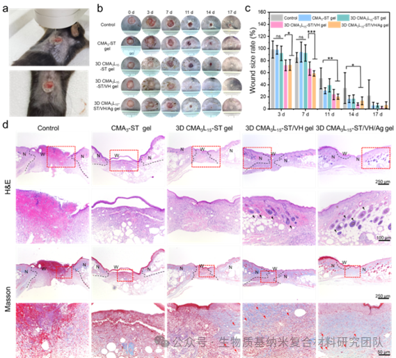 High Self-Supporting Chitosan-Based Hydrogel Ink for In Situ 3D Printed Diabetic Wound Dressing