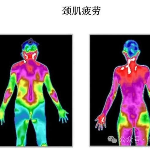 The Infrared Thermal Imaging Device Used in Physiotherapy Clinics: A New Technology for Diagnosis and Visible Therapeutic Effects