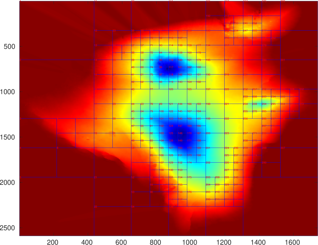 Research on Joint Model for Spatially Varying Stratified Atmospheric Delay Correction in Multi-temporal InSAR