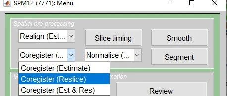 Image Resampling Guide: SPM12 Interface and MATLAB Batch Processing