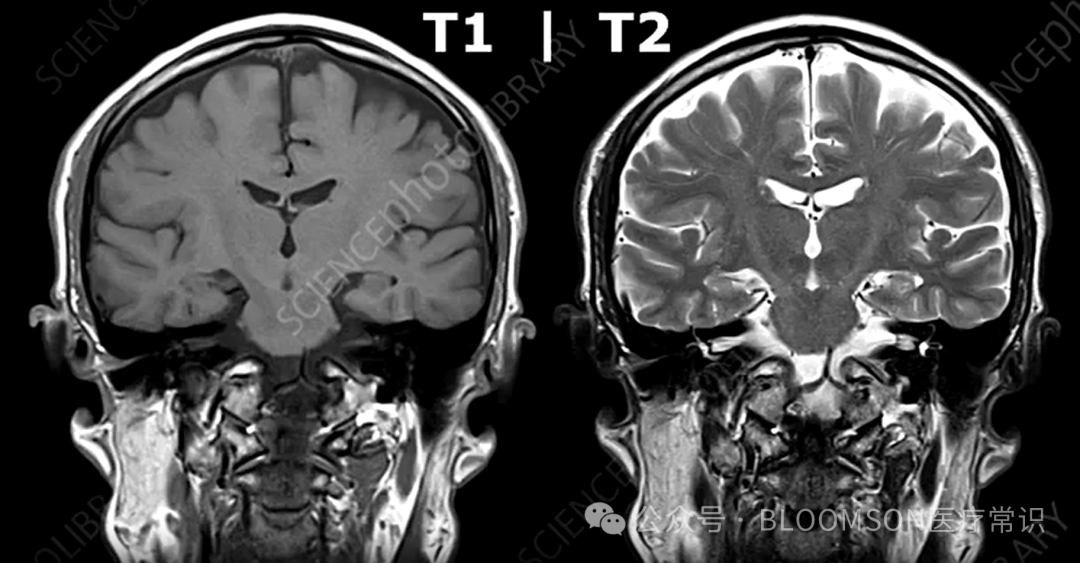 Overview of DWI and ADC Values in MRI