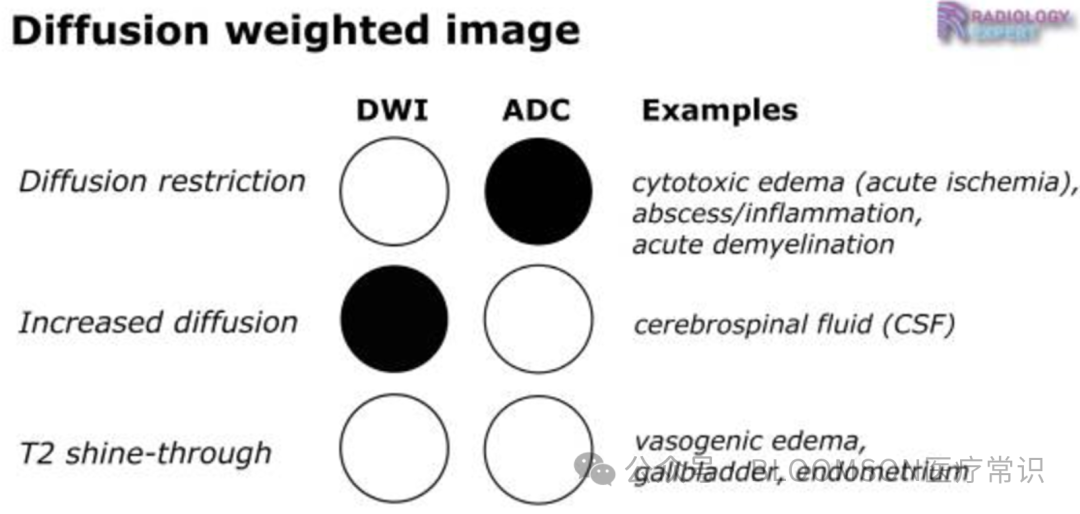 Overview of DWI and ADC Values in MRI