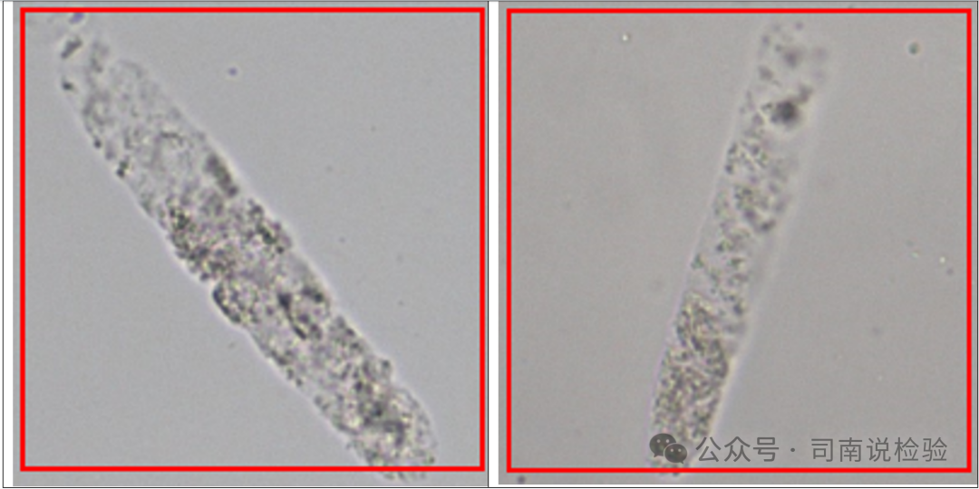 Morphology 127: Urine - Granular Casts (Instrument-Assisted Diagnosis)