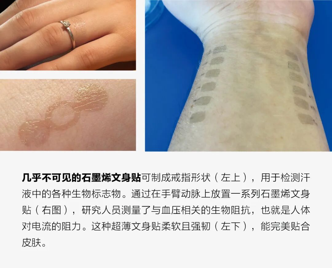 Graphene Biosensor Tattoos: A Glimpse into the Future of Health Monitoring