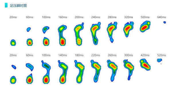 Customizing Foot Arches: The Revolution of 3D Printing