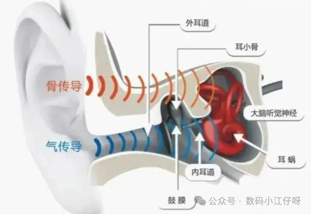 What Are the Advantages of Open-Back Headphones? Recommendations for Open-Back Bluetooth Headphones in 2025