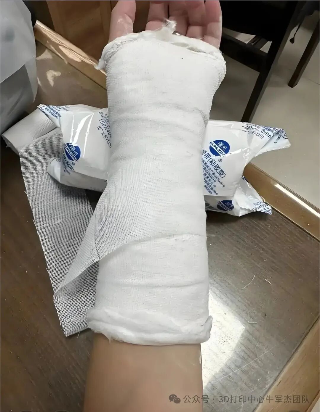 Goodbye to Heavy Plaster: Instant 3D Printing for Precise Orthopedic Rehabilitation!