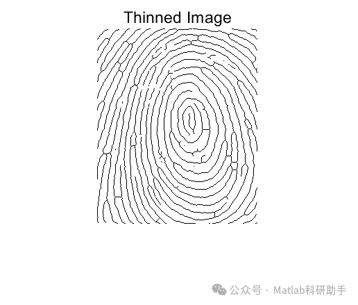 Fingerprint Recognition: Detail Extraction with Matlab Code