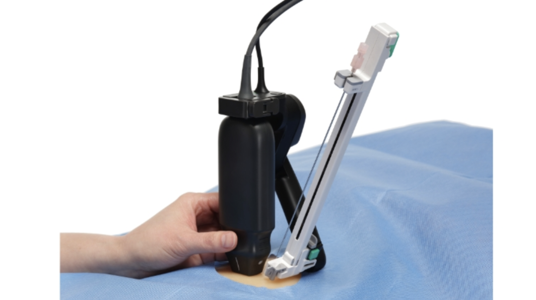 World's First Clinical Application! Breakthrough in Ultrasound + Handheld Robot for Kidney Stone Surgery