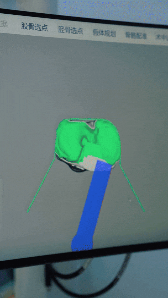 The Future is Here! AI Orthopedic Robots Achieve Human-Machine Collaboration