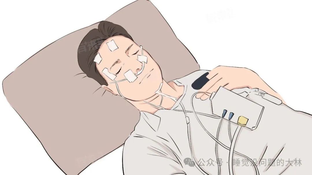 Is Monitoring Sleep with Smartwatches/Rings Reliable?