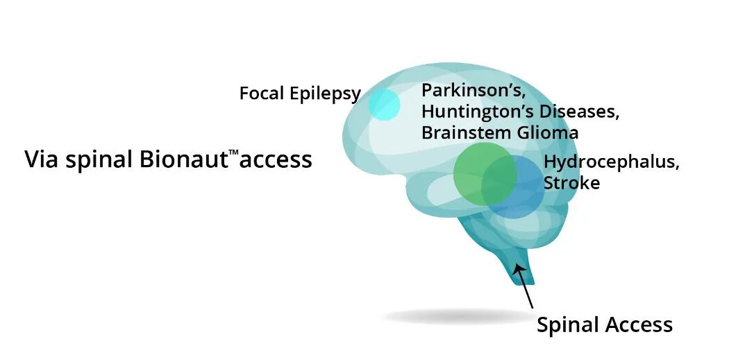 Introducing Microrobots into the Brain: A Revolutionary Approach to Treating Brain Diseases with Clinical Trials Planned Within Two Years